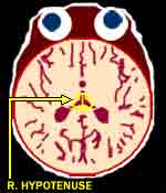 Diagram of brain with R. Hypotenuse highlighted